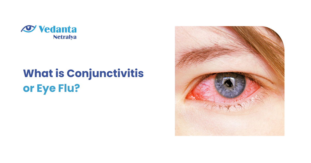 What is Conjunctivitis or Eye Flu?
